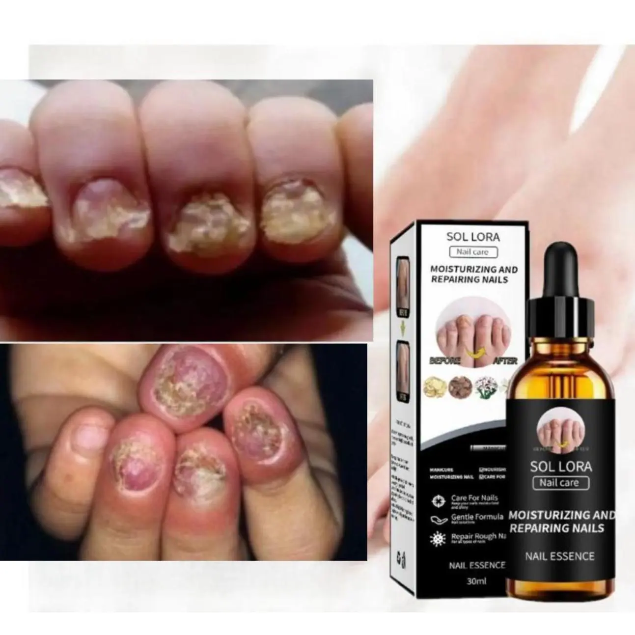 เอสเซ้นส์เชื้อราสำหรับเล็บ, 30ml, บำรุง, ดูแลเชื้อราที่เล็บ, น้ำยาทำความสะอาดเล็บ