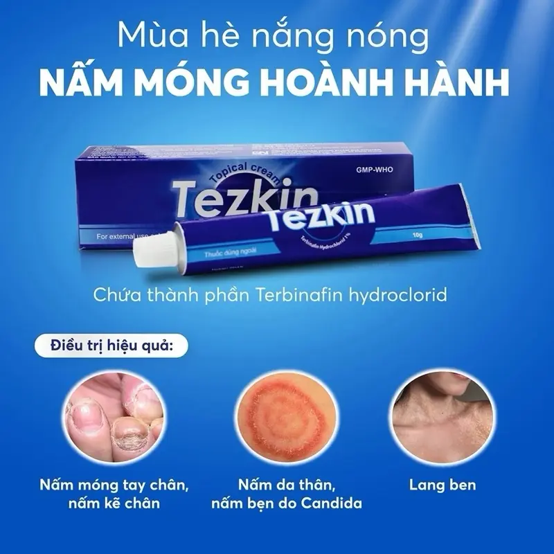 Bôi Trị Nấm Da Tezkin Tuýp 10g. Trị Nấm Da, Nấm Móng, Nấm Kẽ, Lang Ben, Hắc Lào
