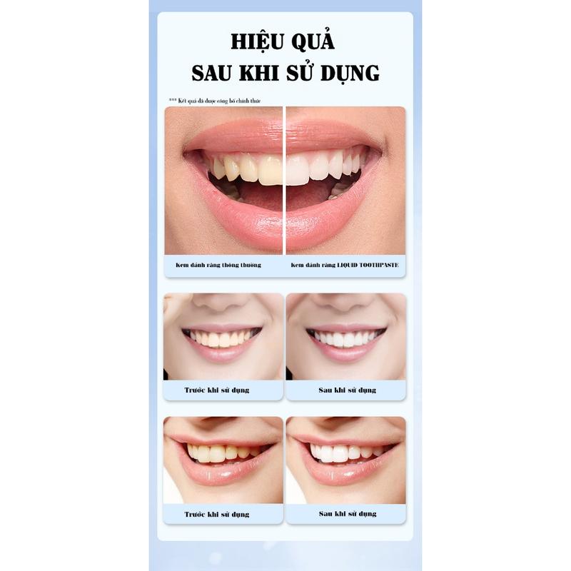 Kem Đánh Răng Liquid Toothpaste Dạng Lỏng Giúp Răng Trắng Sáng Hiệu Quả, Loại Vết Ố Vàng, Hơi Thở Thơm Mát Không chứa gluten Nhạy Bảo vệ nướu Vệ sinh Women Nữ Trắng Răng 4
