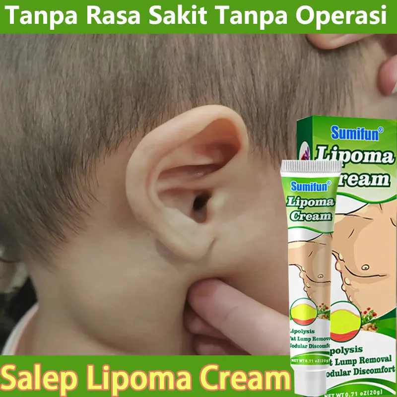 Lipoma Ointment Cream Lipoma Benign Mass Treatment Lipoma Ointment Lipoma Cream Lipoma Ointment Cream Benign Mass 100% Original Fibroid/Subcutaneous Mass