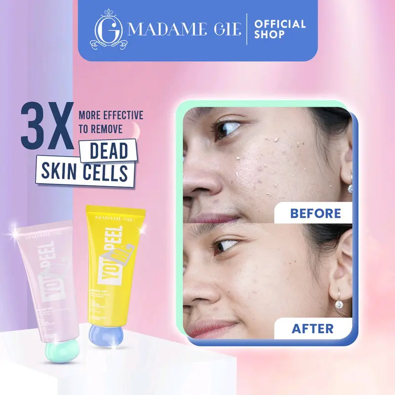 Madame Gie Madame You Peel Me - Peeling Gel 2