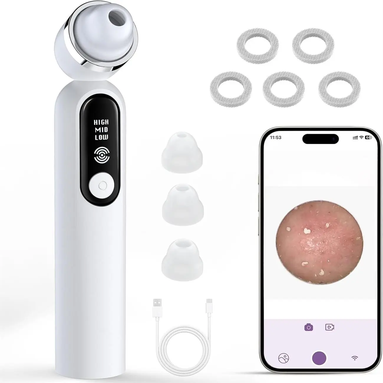 Visual Blackhead Vacuum Cleaner, Rechargeable Facial Cleansing Tool with Cleaner Suction & Silicone Probes