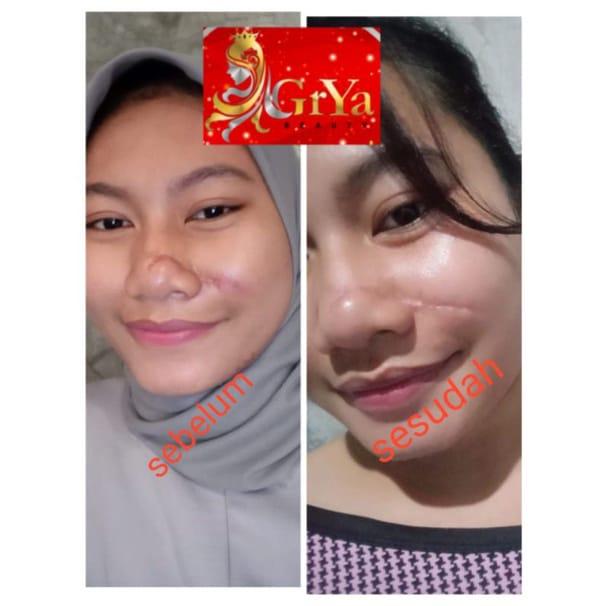 GRYA BEAUTY BODY SERUM DNA SALMON CREAM SKINCARE ORIGINAL BPOM 6