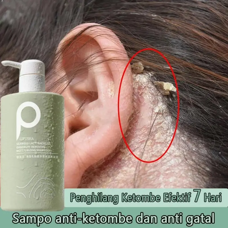 Original Sea Salt Sampo 500ML anti ketombe sampoo ketombe minyak kelapa asli sampo psoriasis sampo pengontrol minyak kulit kepala gatal 0