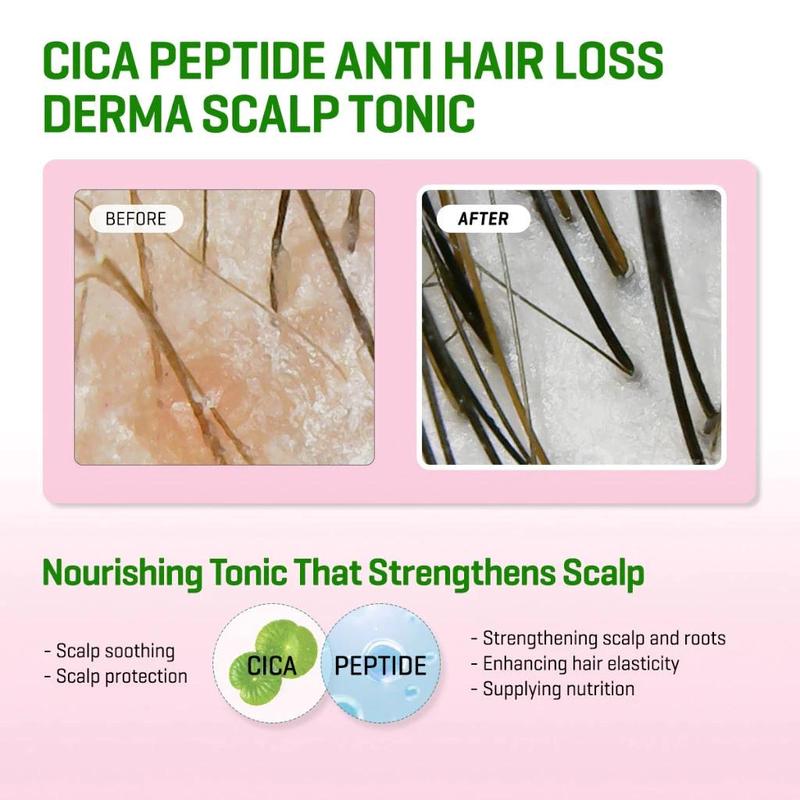 Product Introduction of 【SOME BY MI】 Cica Peptide Anti Hair Loss Scalp Tonic 150ml 5