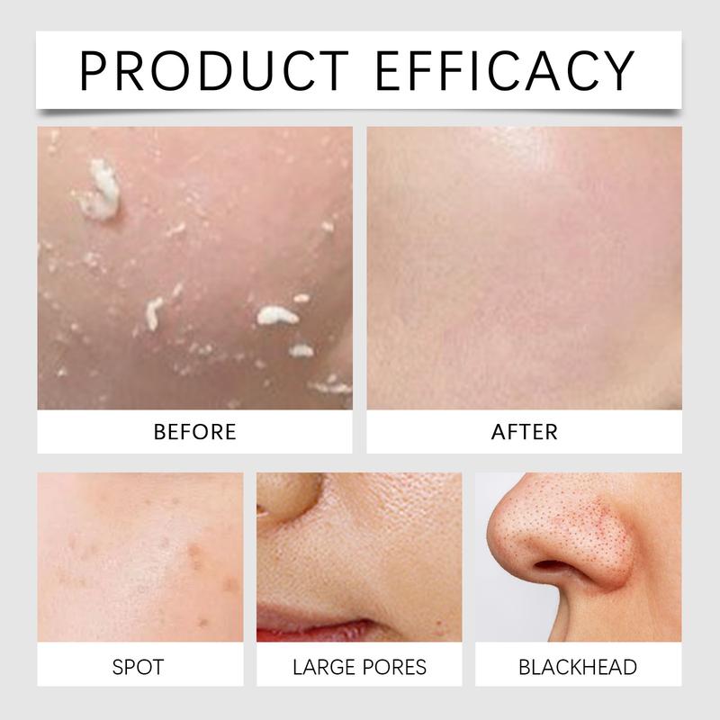 Product Introduction of EAST MOON men's facial moisturizing cream, men's cream, men's facial moisturizing cream, men's facial moisturizing cream, men's facial skin nourishing and rejuvenating moisturizing cream, men's cosmetics. Skincare Comfort 10