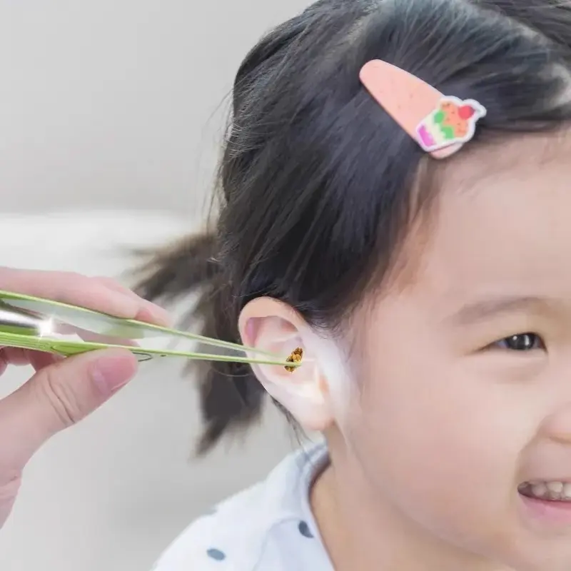 Nhíp Nhổ Tai Phát Sáng, Dụng Cụ Vệ Sinh Tai Cho Trẻ Em, Bộ Dụng Cụ Nhíp Vệ Sinh Tai Cho Bé Có Đèn 1