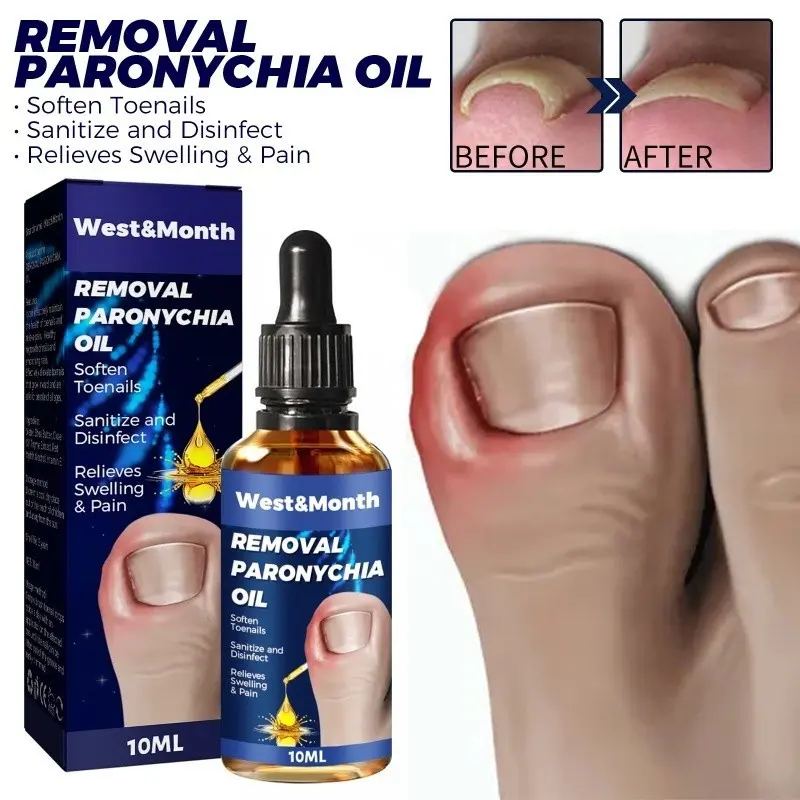 Dầu Giảm Paronychia, 10ML, Để Điều Trị Móng Nấm Móng Tay Mọc Lông, Điều Trị Vôi, Serum, Chống Nấm Móng