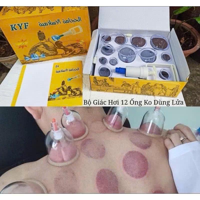 Cốc Giác Hơi Silicon – Bộ Giác Hơi Gia Đình – Giác Hơi Chân Không Hiện Đại 3