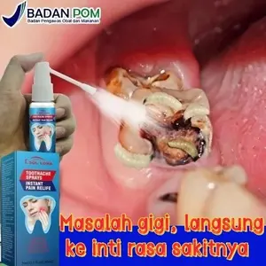 SOL LORA Pereda Sakit Gigi Obat Gusi Bengkak Sakit Gigi Gigi Berlubang Radang Gusi Plak Gigi Periodontitis Gingivitis Abses Gigi Perikoronitis Bau Mulut Gusi Berdarah