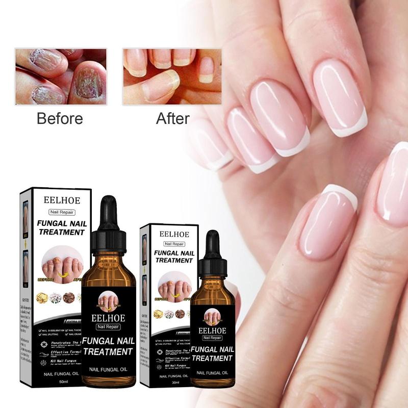 Dung dịch phục hồi móng tay EELHOE giúp móng dày hơn và sáng hơn. Loại bỏ nấm móng tay Phục hồi độ ẩm và chăm sóc móng tay 1