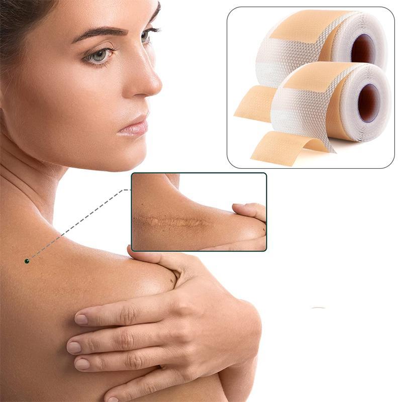 Reusable Silicone Sports Tape (1 Roll), Waterproof & Soft Elastic Sports Tape, Sports Accessories 3
