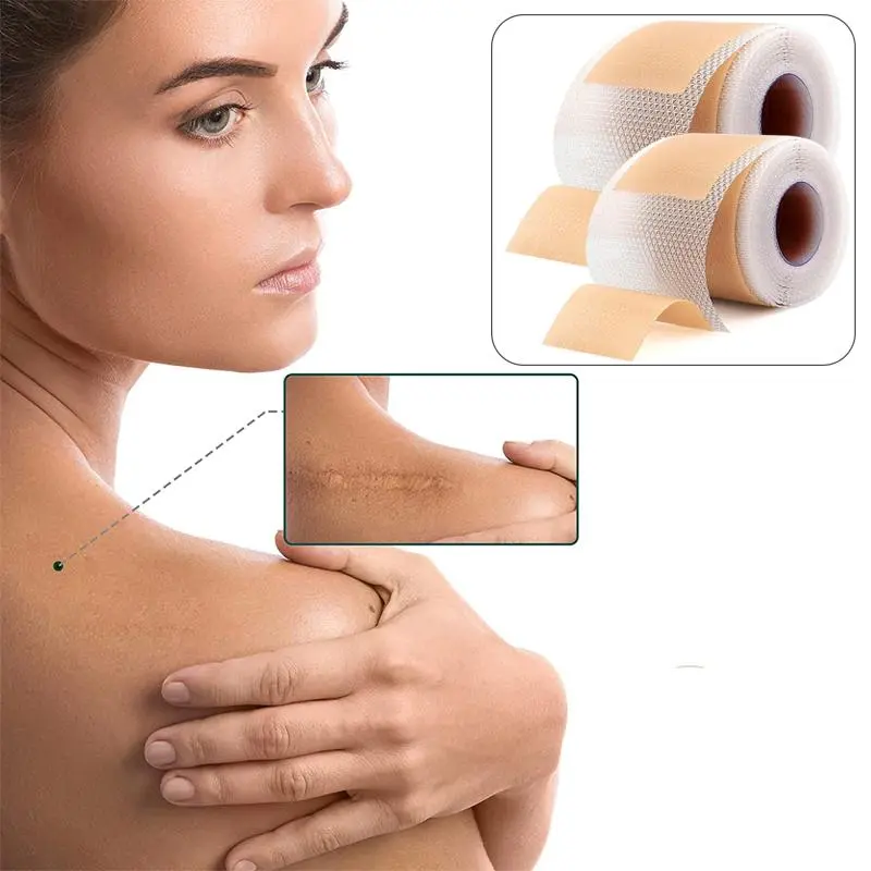 Reusable Silicone Sports Tape (1 Roll), Waterproof & Soft Elastic Sports Tape, Sports Accessories 3