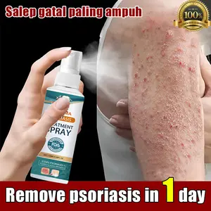 Salep gatal paling ampuh spray gatal selangkangan salep gatal kulit yang ampuh Salep gatal selangkangan Salep gatal pada miss v Anti jamur Menghilangkan Psoriasis Eksim Kurap spray Gatal Kelamin Obat Gatal Bokong Dan Selangkangan 100ML