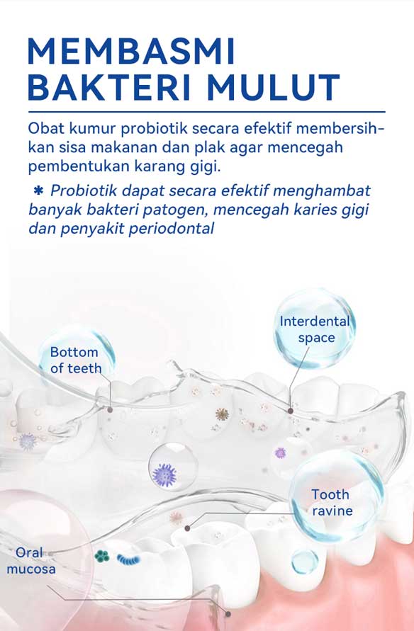 [BPOM] MeToo Mouthwash Fresh Mint 100ml /nafas segar / menghilangkan bau mulut / kumur karang gigi / non-alkohol