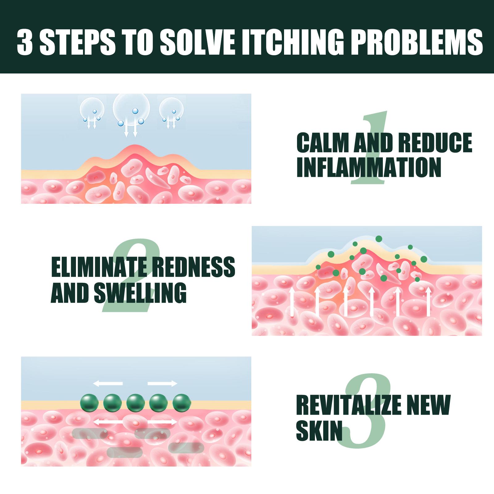 Salep Psoriasis Anti-Gatal Paling Efektif Salep Gatal Cina 0 Obat Gatal Selangkangan Paling Efektif Salep Eksim Kering 20g Salep Gatal Selangkangan 0 Obat Gatal Genital Obat Gatal Kulit Perbaikan Kulit Salep Psoriasis Anti-Gatal Paling Efektif Salep Gatal Cina 0 Obat Gatal Selangkangan Paling Efektif Salep Eksim Kering 20g Salep Gatal Selangkangan 0 Obat Gatal Genital Obat Gatal Kulit Perbaikan Kulit