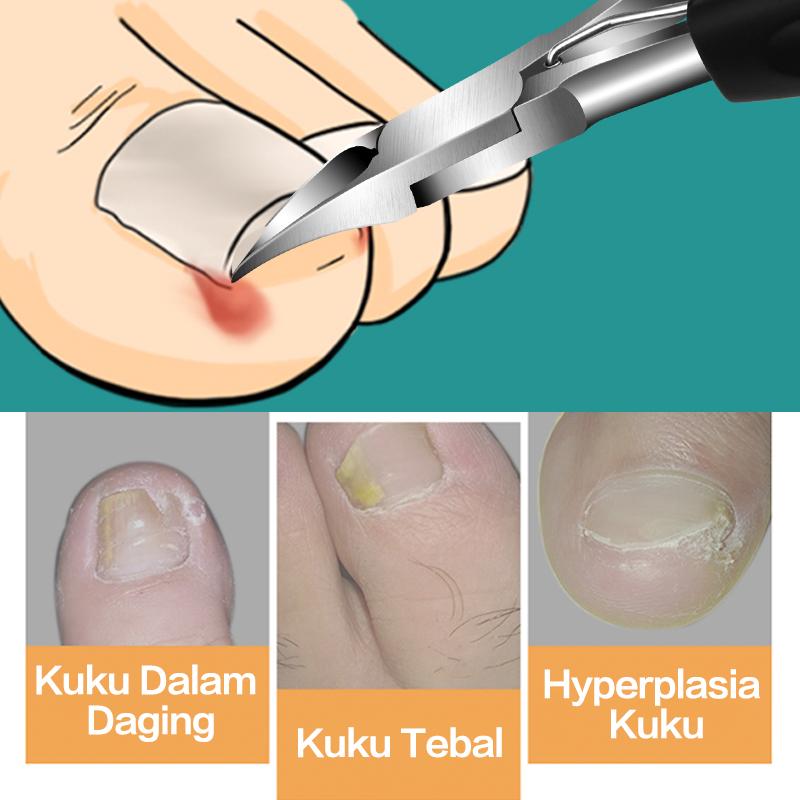 Gunting Kuku Miring Anti Cantengan Pemotong Kuku Miring Jempol Kaki Stainles Steel 5