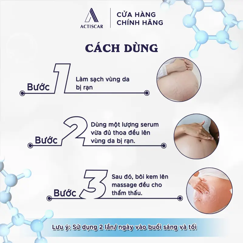 ACTISCAR Combo mờ rạn da - Hỗ trợ ngăn ngừa hình thành rạn mới, dưỡng ẩm, mờ rạn và tái tạo da (Serum 30ml và Kem 100g) 3