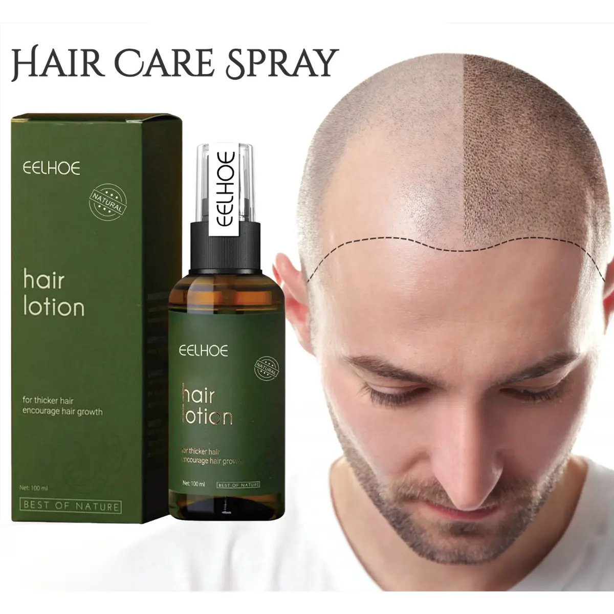 Eelhoe-Xịt Bưởi Mọc Tóc Cho Nam Và Nữ, Sửa Chữa, Nuôi Dưỡng Chân Tóc, Mọc Lại, Điều Trị Chống Rụng Tóc, Tinh Dầu (100Ml)