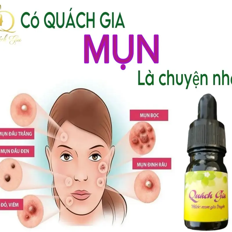Serum Quách Gia Giảm Mụn- Trắng Da  Đẹp Da  5ml. Skincare Chăm Sóc Da Women 5