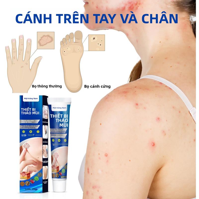 Kem Rụng Mụn Thịt Dư South Moon Cao Cấp 20g gel  chấm  mụn  mờ  thâm 3