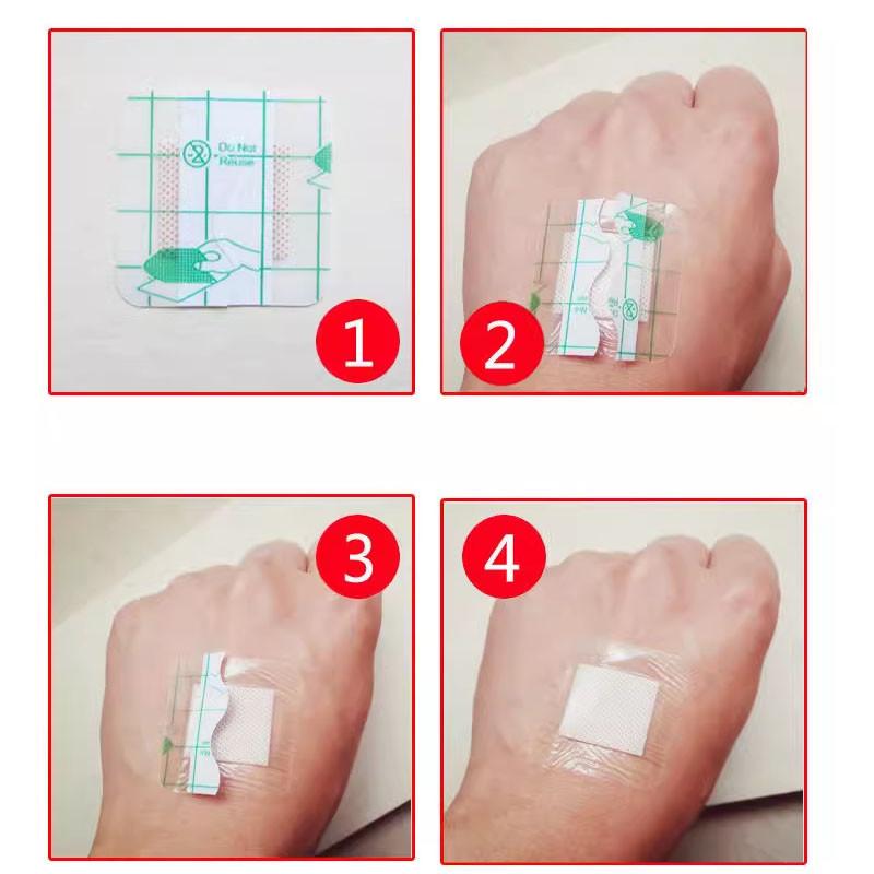 Vinnatsu Stiker Pelindung Penutup Telinga / Waterproof Ear Patch /Pita Anti Air / Tahan Air Luka Plester /Dressing Roll Pita Vinnatsu Stiker Pelindung Penutup Telinga / Waterproof Ear Patch /Pita Anti Air / Tahan Air Luka Plester /Dressing Roll Pita