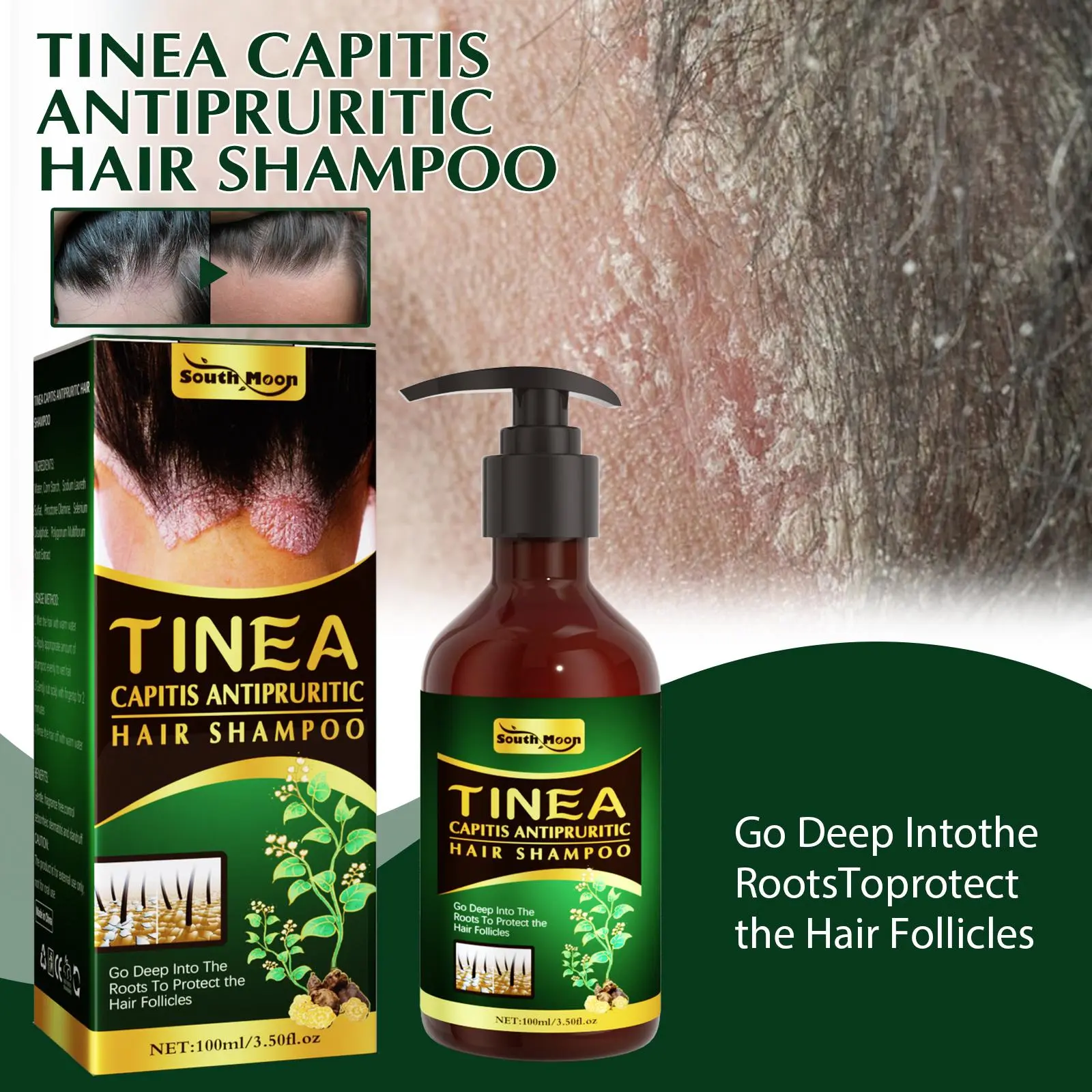 100ml Tinea Capitis Shampoo Soothing Relieves Itchy Formula Scalp G4I7 Conditioner Haircare Cleanser Cleansing