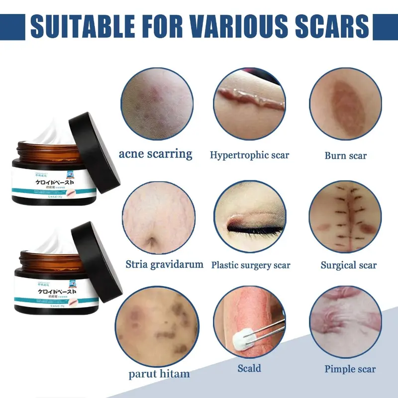 Salep Penghilang Bekas Luka Susu Tubuh Penghilang Bekas Luka Koreng Hitam Penghilang Bekas Luka Gigitan Nyamuk, Stretch Mark, Penghilang Bekas Luka Jahitan 6