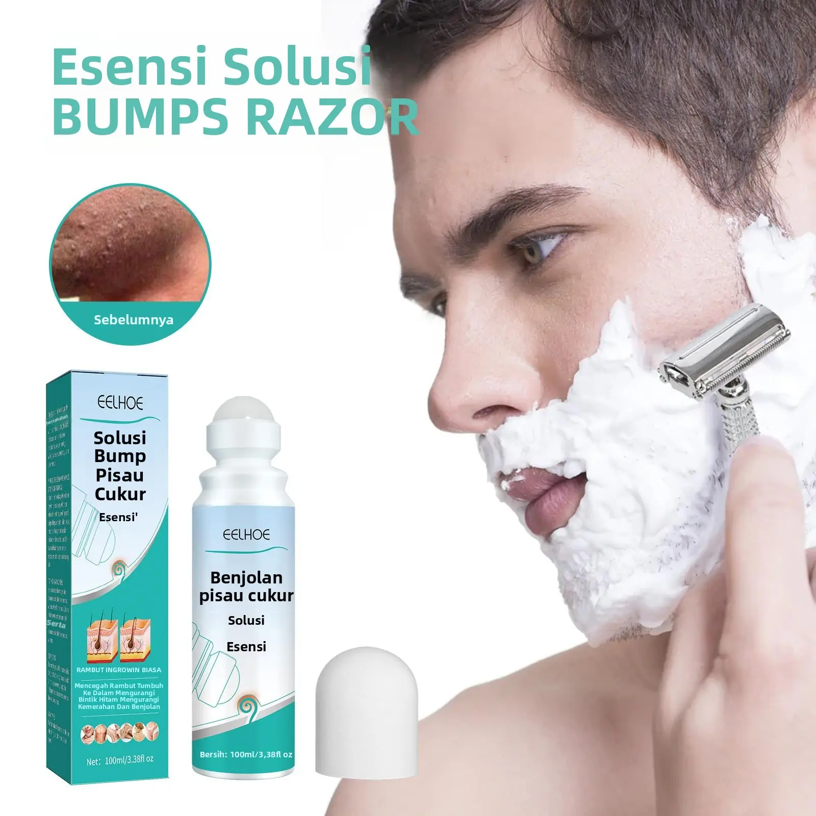 Eelhoe Shaving Lump Repair Roll Essence, Mencegah Rambut Tumbuh Ke Dalam dan Memperbaiki Benjolan Kulit Pencukur Kumis Wajah Melembutkan