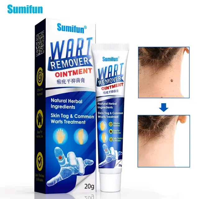 Sumifun 20G Penghilang Kutil Salep Perawatan Kutil Krim Penghilang Tag Kulit Ekstrak Herbal Plester Jagung Salep Kutil K10013 6