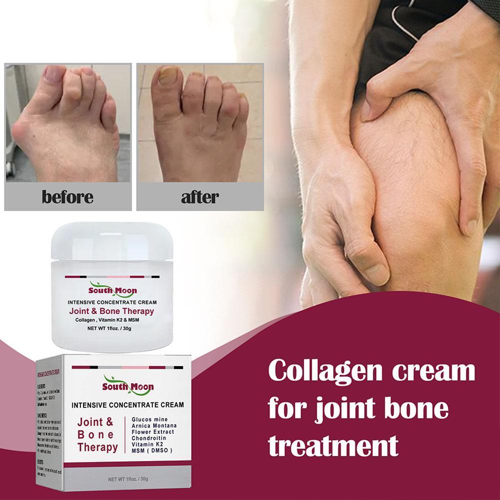 South Moon Joint Bone Therapy Intensive Concentrate Dan Pengobatan Terapi Sendi Krim Pereda Y9R3