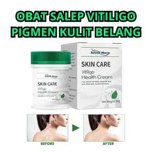 Obat Vitiligo, Obat Penyakit Kulit, Obat Bercak Putih Pada Kulit, Obat Vitiligo di Wajah dan Lengan, Obat Menghilangkan Vitiligo, Obat Penghilang Vitiligo, Obat Pemudar Bercak Putih di Tubuh, Obat Salep Vitiligo Di Punggung