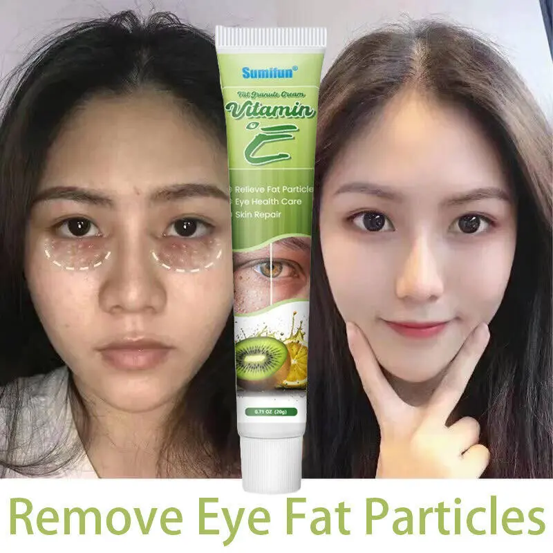 Krim Herbal Penghilang Milia dan Bintik Lemak Area Mata & Hidung dengan Vitamin E - Perawatan Wajah 20g | Formula Alami Efektif 0