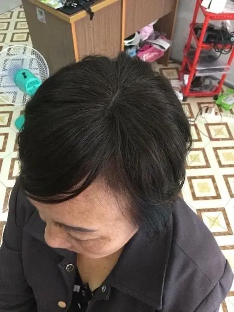 Tóc Che Hói Đỉnh Đầu có Mái,Che Tóc Bạc,Che Hói Làm Dày Tóc giả 4