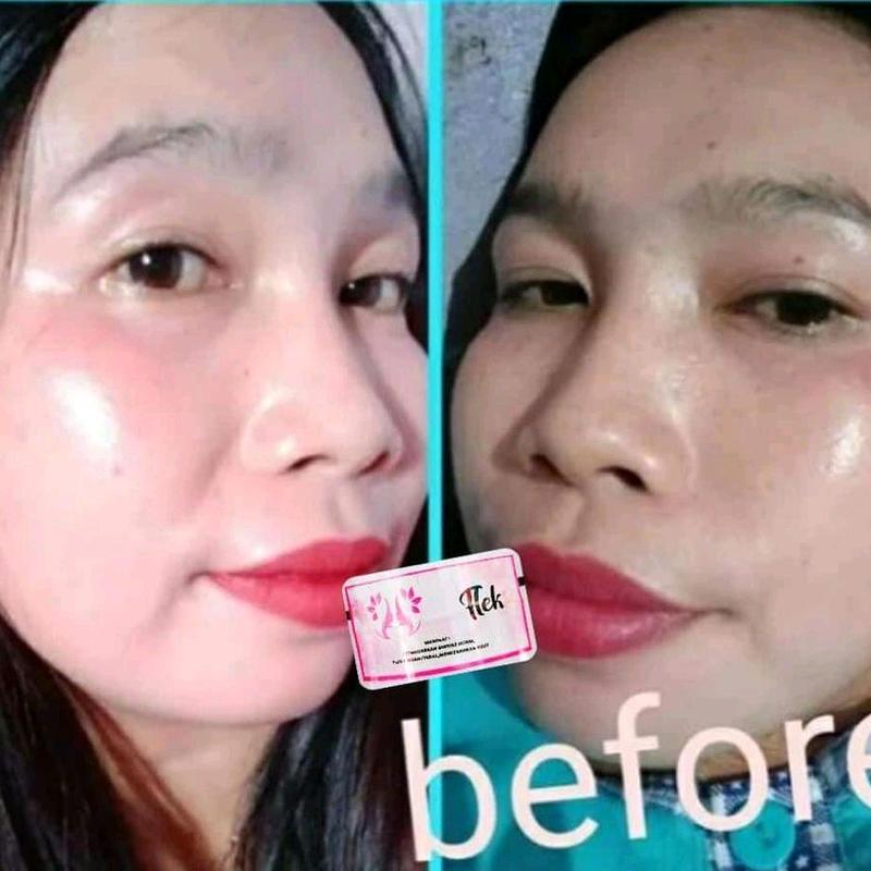 crem flek,glow,acne SPF 30 Semua Jenis Kulit 5