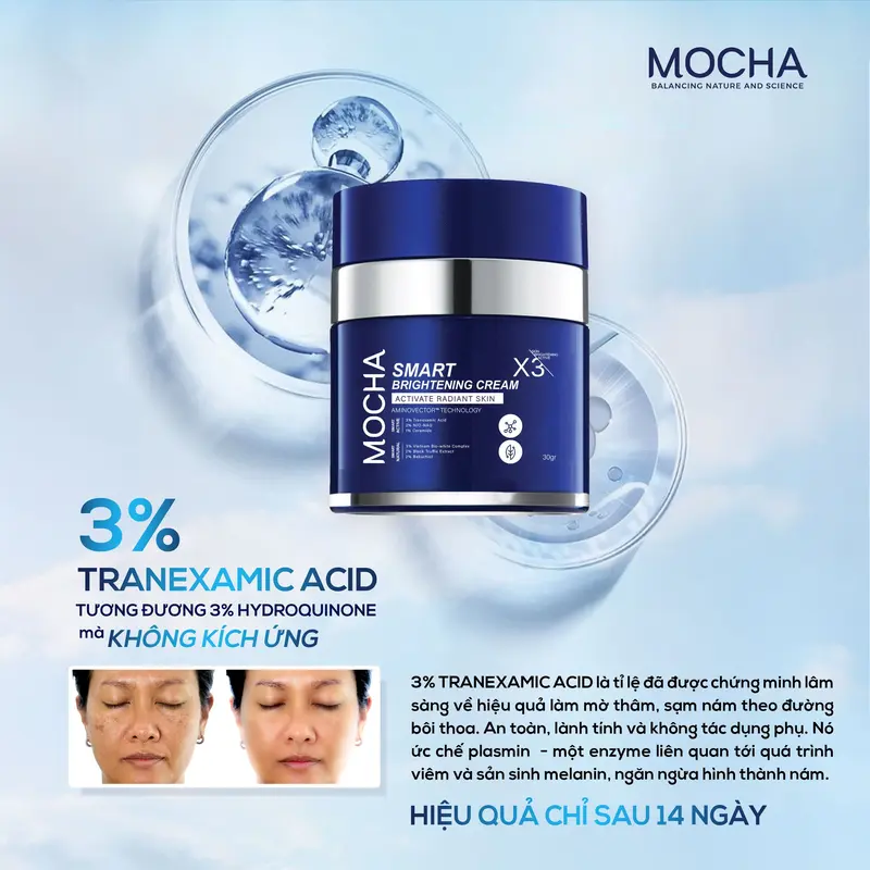 Kem Giảm Sạm, Nám, Tàn Nhang Chuyên Sâu Mocha - Tặng 1 Sửa Rữa Mặt 25ml - Skincare Kem Nám Sạm Tàn Nhang Chăm Sóc Da Làm Đẹp Da Nữ Dưỡng Ẩm Da Women 2
