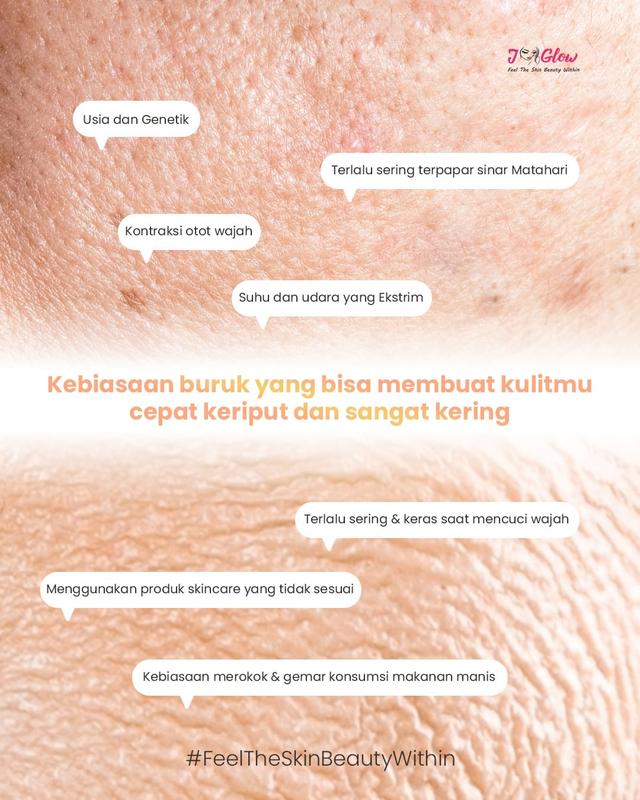 JGLOW JELLY SERIES ACNE CARE GEL RED LUMINOUS GEL Berminyak Beruntusan 4