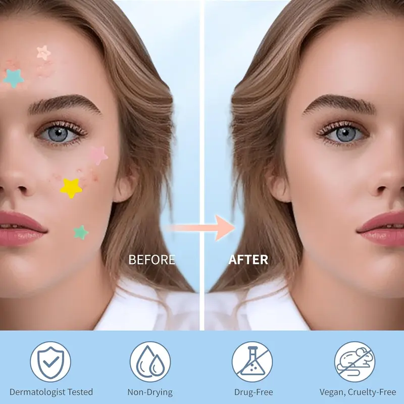 Star Shaped Hydrocolloid Acne Patches, Invisible Acne Patches, Blemishes Pimples Covering Patch, Skin Care Products for Women & Men 4