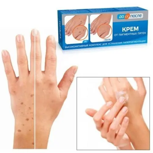 Kem Đồi mồi Kpem 50ml - Hàng nội địa NgA 4