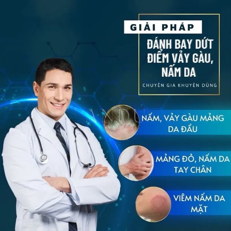 Kem Bôi Nấm Ngứa Viêm Da Cơ Địa Hỗ Trợ Dứt Điểm Hắc Lào, Nấm Da Đầu, Ghẻ Nước Hiệu Quả Nhanh - BÀ LÃO XANH 3