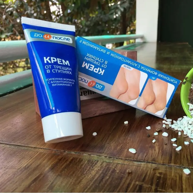 Kem Hỗ Trợ Giảm Nứt Gót Chân Nữ Kpem Nga Chính Hãng 50ml Cosmetic Women 1