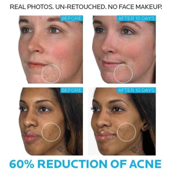 La Roche Posay Effaclar K+ Moisturizer 40ml - Pelembab Wajah Kulit Berminyak/ Mengurangi minyak dan melawan komedo 5