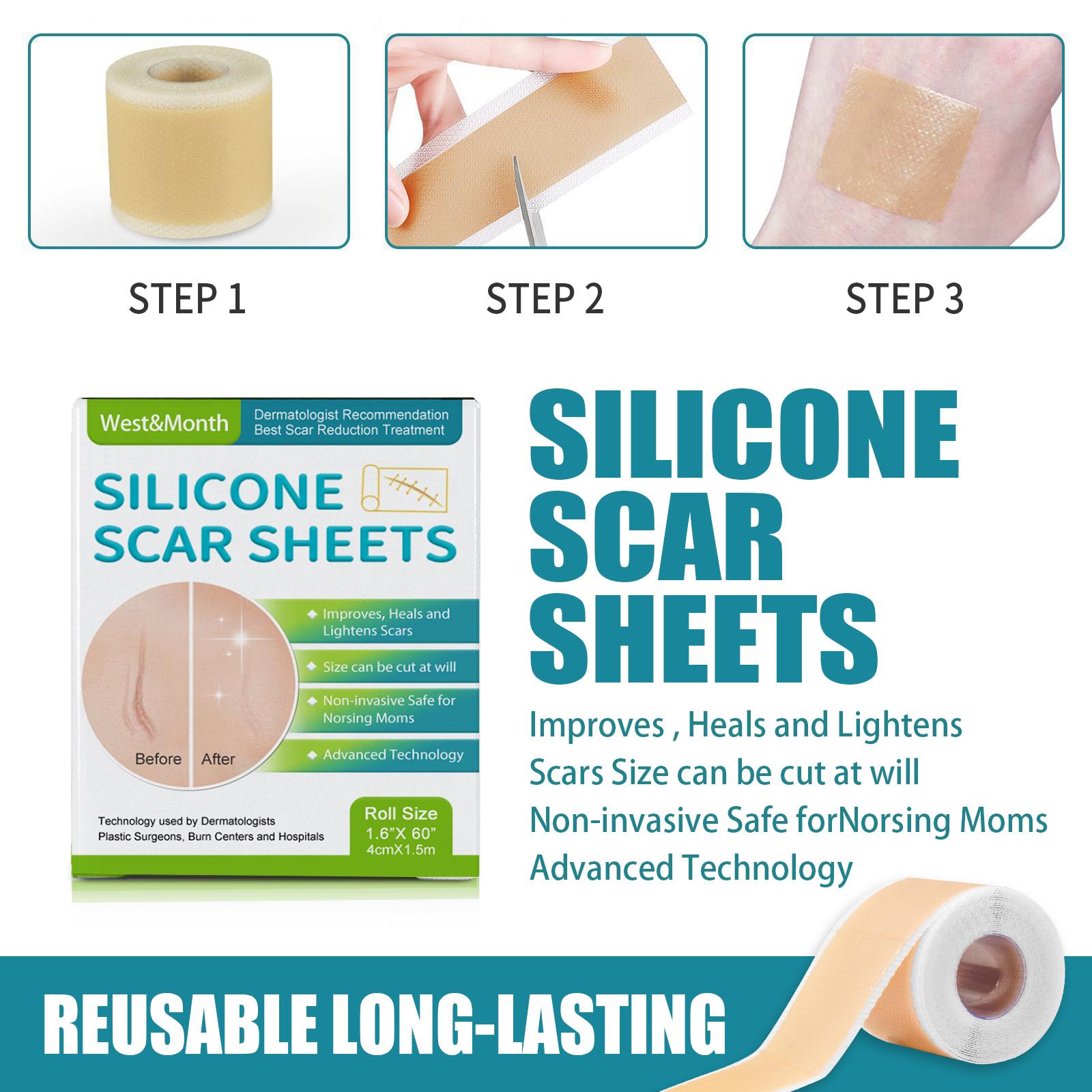 Silicone Scar Sheet Surgical Scar Cesarean Scar Covering Sticker ...