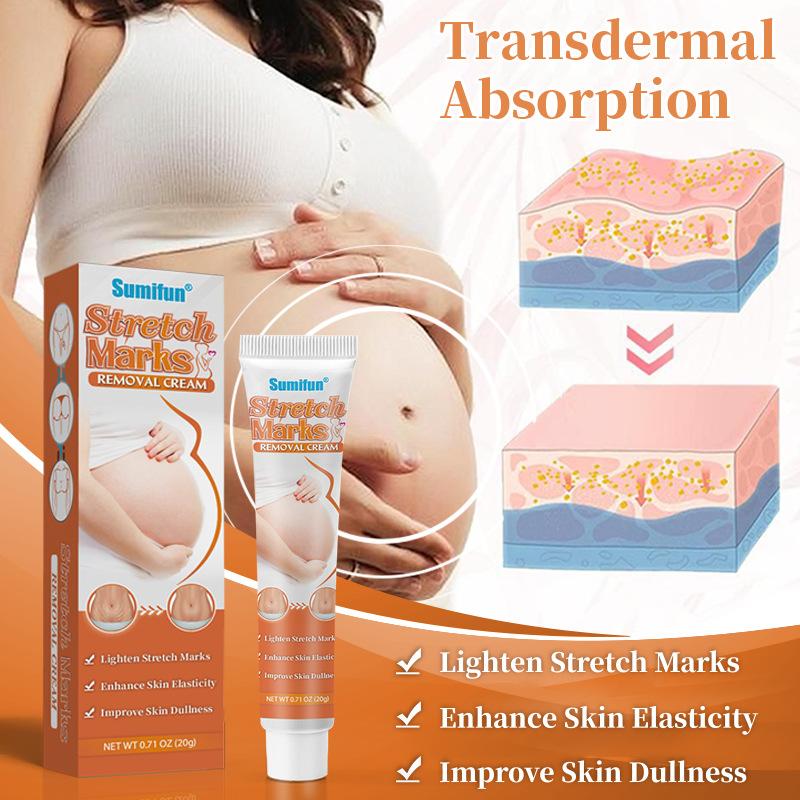 Kem Chống Rạn Da, Điều Trị Da Chuyên Sâu, Để Cải Thiện Và Loại Bỏ Sự Xuất Hiện Của Vết Rạn, Thích Hợp Để Loại Bỏ Vết Rạn Cắt, Hiệu Quả Để Loại Bỏ Đường Béo Và Vết Rạn Sau Sinh, Kem Phục Hồi Cơ Thể, Làm Sáng Da, Hiệu Quả Sau Khi Rạn Da 6