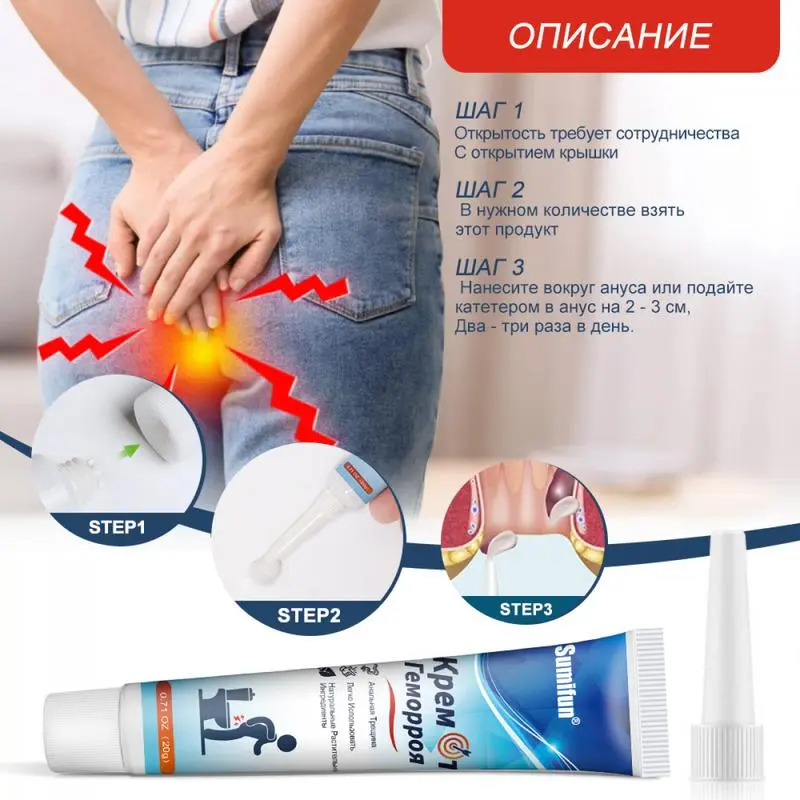 Kem trĩ tự nhiên, kem trĩ giảm đau và ngứa, kem trĩ dành cho người lớn ít vận động, phù hợp cho cả nam và nữ，20g kem  ketoconazole 2