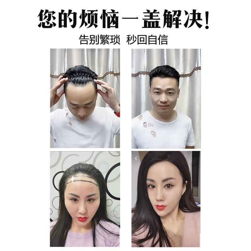 Hairline Wig Men's Wig Patch Forehead Replacement Piece Real Hair Full Hand-woven Biological Scalp Bangs 3