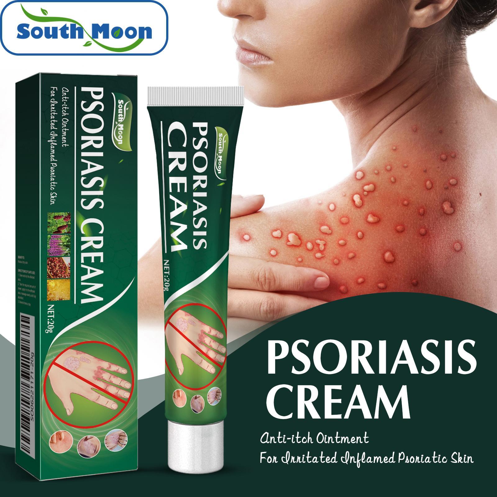 [Penjualan Panas] Raja Anti-Gatal!Krim Herbal Asli, Spesialisasi Eksim dan Dermatitis Jamur, Efek Terlihat Salep Gatal Salep Psoriasis Obat Cepat dan Efektif untuk Gatal di Bokong dan Selangkangan Obat 30g Psoriasis / Kulit Gatal / Gatal Paha Dalam Alergi