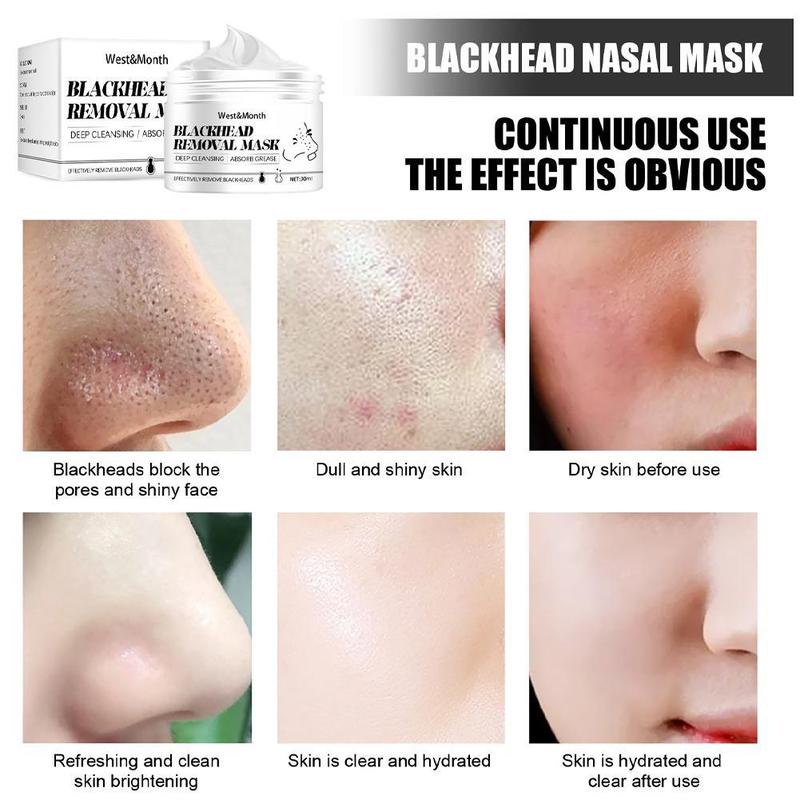 Blackhead Removal Nasal Mask Deep Cleaning Face Remove Blackheads Acne Shrink Pore 4