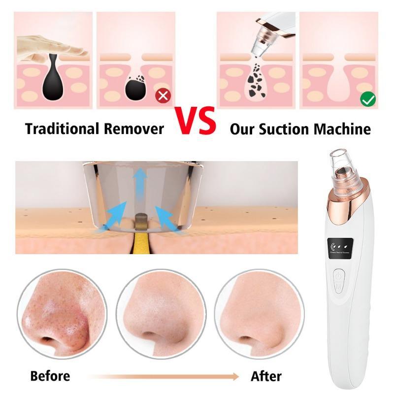 Product Introduction of USB Rechargeable Electric Pore ​​Cleanser, 1 Box Vacuum Suction Blackhead Instrument with 5 Beauty Heads & Acne Needles, Facial Beauty Instrument, Christmas 7