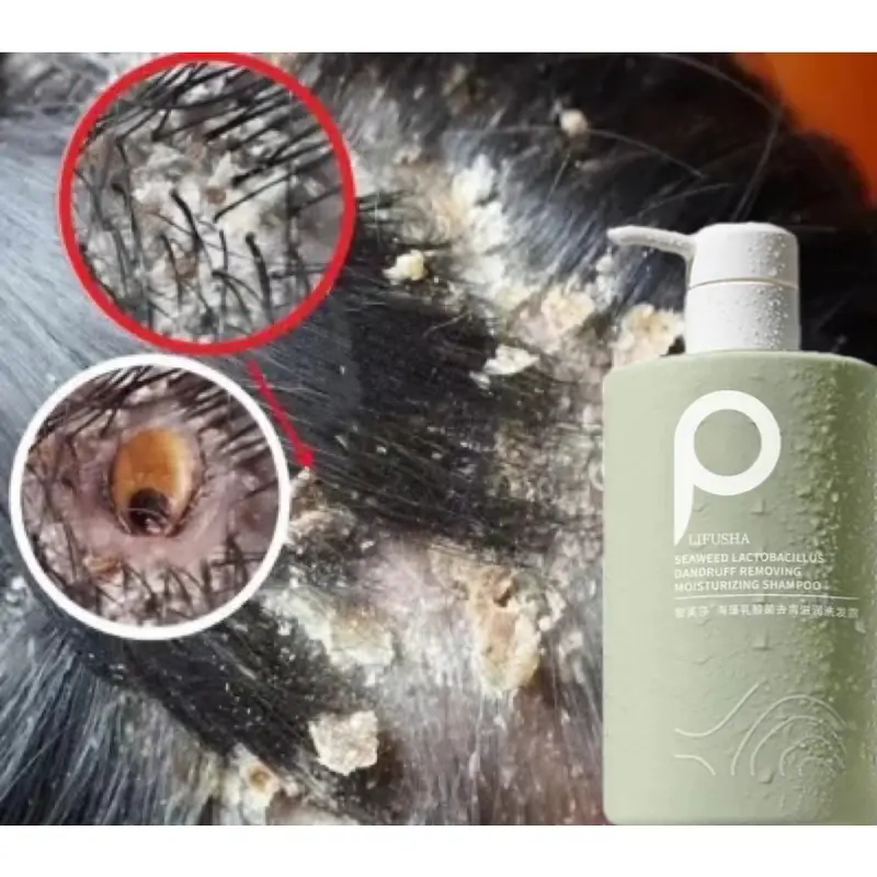 Original Sea Salt Sampo 500ML anti ketombe sampoo ketombe minyak kelapa asli sampo psoriasis sampo pengontrol minyak kulit kepala gatal 2